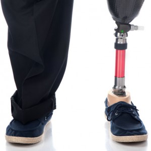 shutterstock_prosthetic