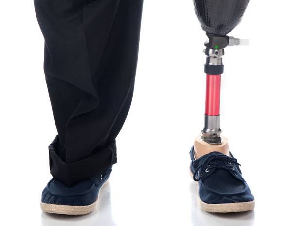 shutterstock_prosthetic